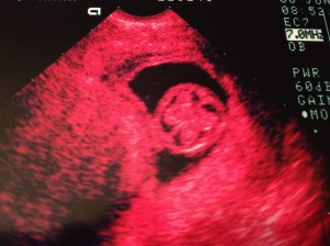 This ultrasound shot of The Boy's Brain is probably the closest I'll ever get...
